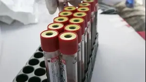 מבחנות דם נשלחות לבדיקות HIV. הונדורס, דצמבר 2009