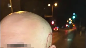אם ובנה הותקפו קשות על ידי שכניהם בפתח תקווה